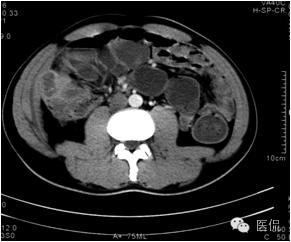 鐥呯悊鍒囩墖闃呯墖澶ц禌,鐥呯悊闃呯墖姣旇禌