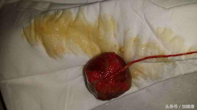 增加健康小知识,增加健康科普小常识