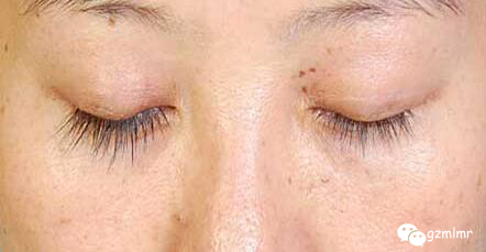 顶着这样的睫毛出街，让人尴尬症都犯了！