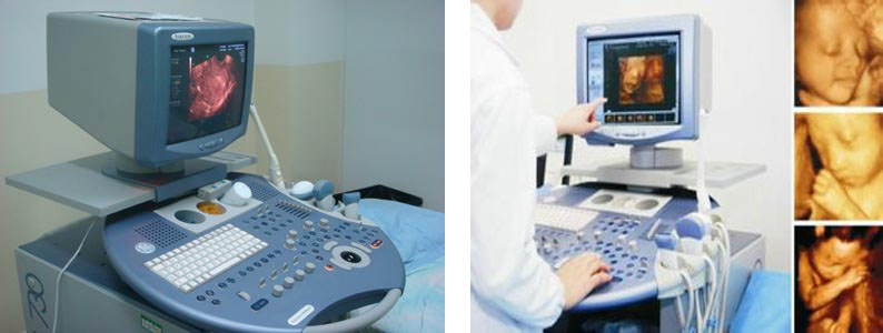 媳妇怀孕了，四维彩超能帮助我们了解什么？