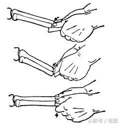 小孩尺桡骨骨折后期自我塑形,儿童尺骨桡骨远端骨折第九周