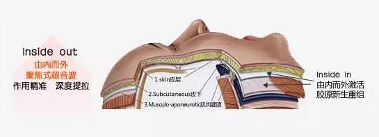 史上最全的超声刀资料与问答，看了都不用请教专家！