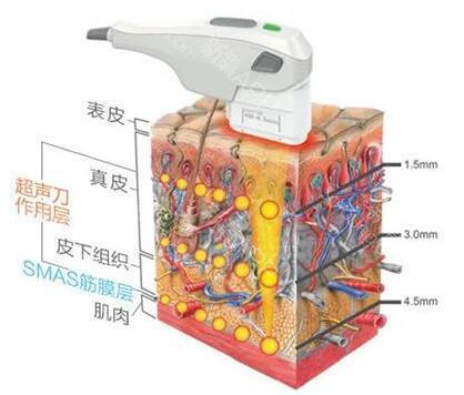 超声刀全部视频,超声刀图解全册