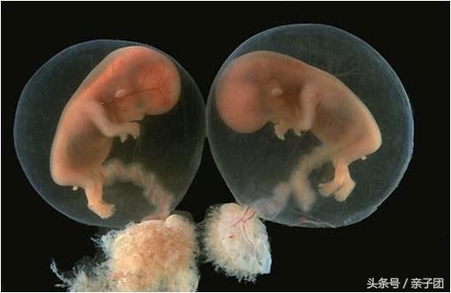 孕早期反复出血是什么原因引起的,孕早期出血可能是什么原因导致