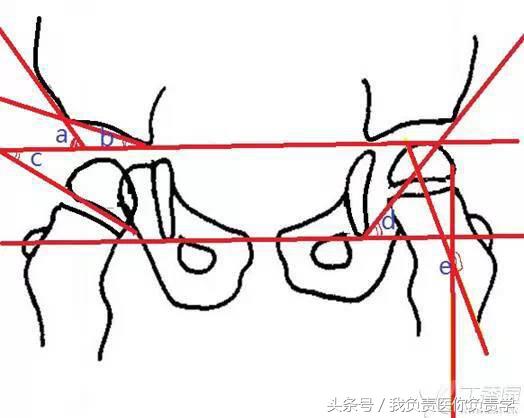 正常骨盆x线片详解,骨科医生只看报告单