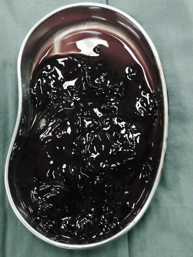 解放军306医院除夕之夜倒计时与正计时