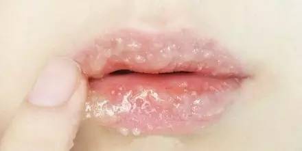 唇部去角质全过程,滋润双唇的有效唇部去角质方法