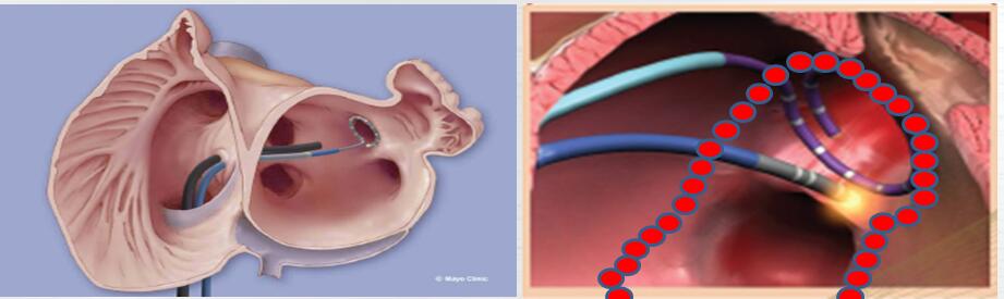 心脏突然突突突乱跳几秒又好了,心脏总是不规律的乱跳原因是什么