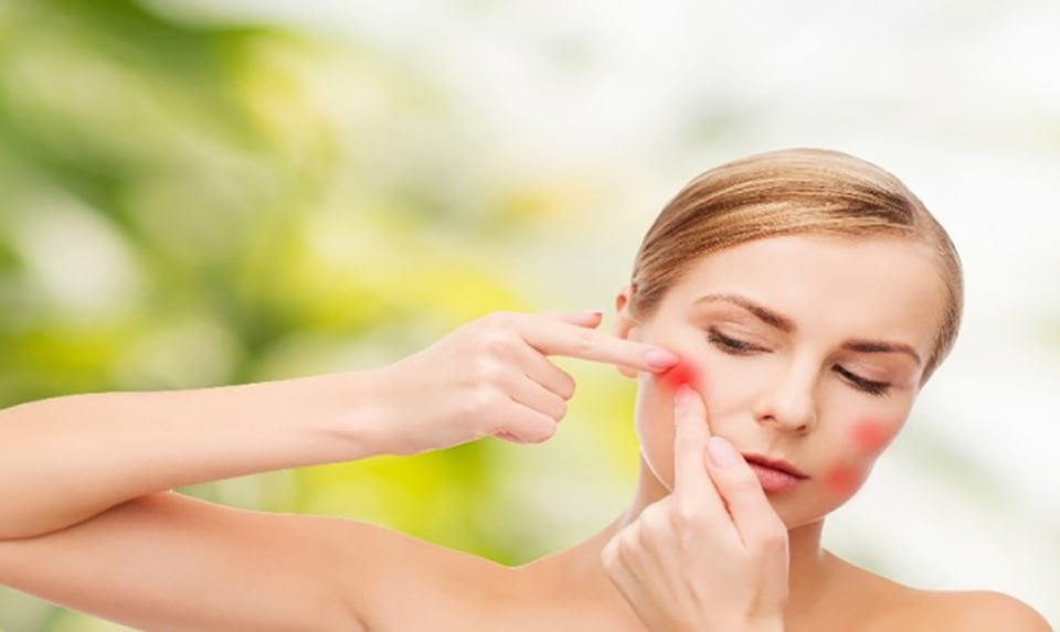 脖子闭口粉刺怎么去除小妙招,粉刺怎么去除简单方法学生