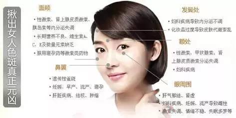 *褐斑黄**是身体内部出了问题!老中医告诉你不同部位长斑的问题?