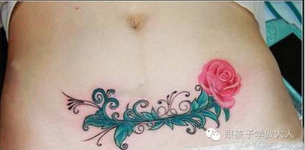 剖腹产8大禁忌,剖腹产后注意事项及禁忌