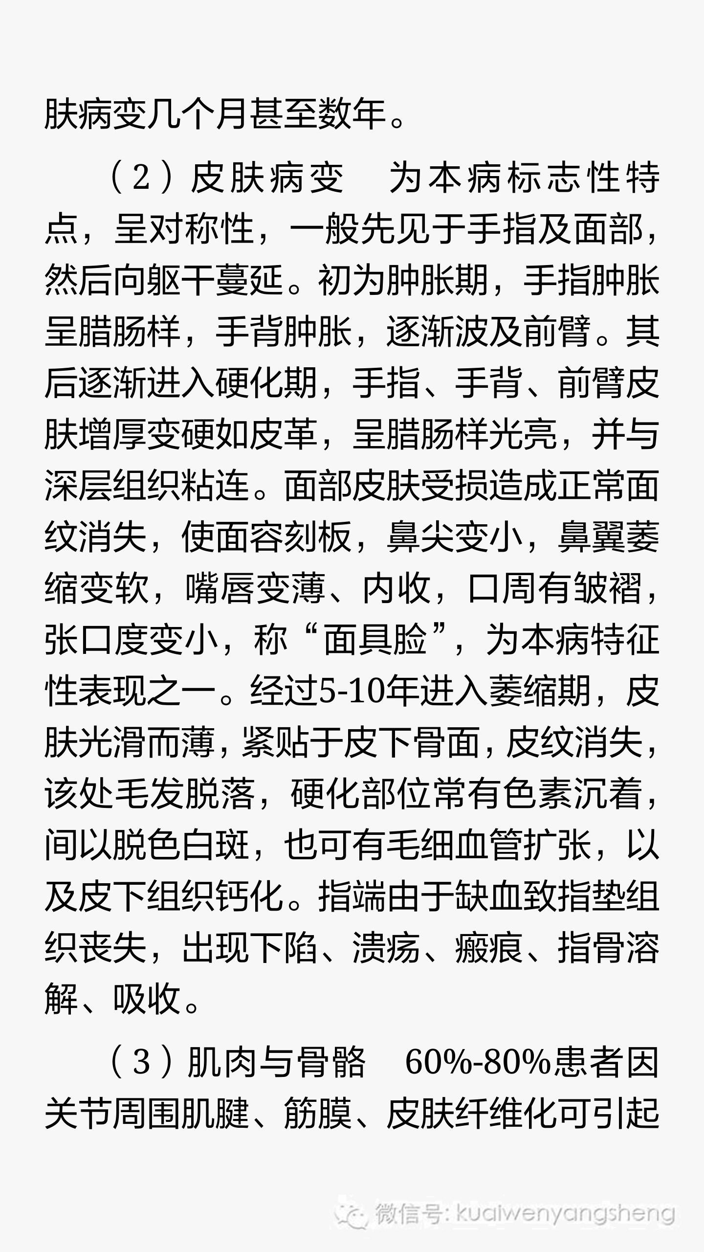 皮痹与硬皮病是一回事吗,硬皮病中药由寒凉引起的治疗方法