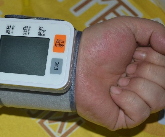 电子血压计腕式和臂式哪个比较准,腕式电子血压计如何正确量血压