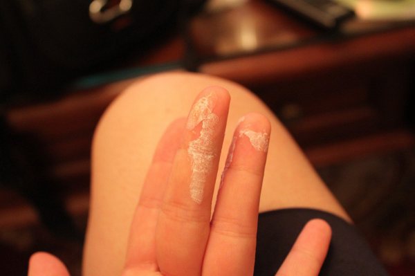 怎么清除衣服上大面积的万能胶,如何去掉大白胶粘在衣服上的胶