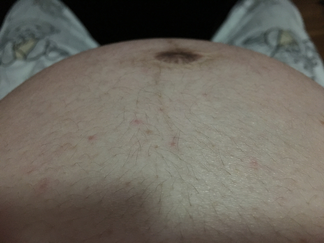 妇产科医生告诉你孕肚长毛，是否生男孩子！