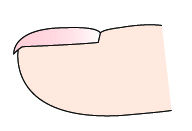 指甲竖纹里面有白点是什么原因,指甲有竖纹和白点是怎么回事