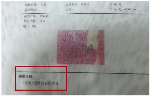 胃镜检查一定要活检才知道胃癌吗,胃镜活检怎么看出胃癌