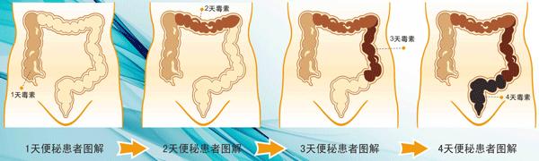 孕期便秘用开塞露对胎儿有影响,便秘使劲拉对胎儿有什么影响