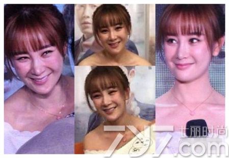 扒一扒韩国明星整容,整容保质期