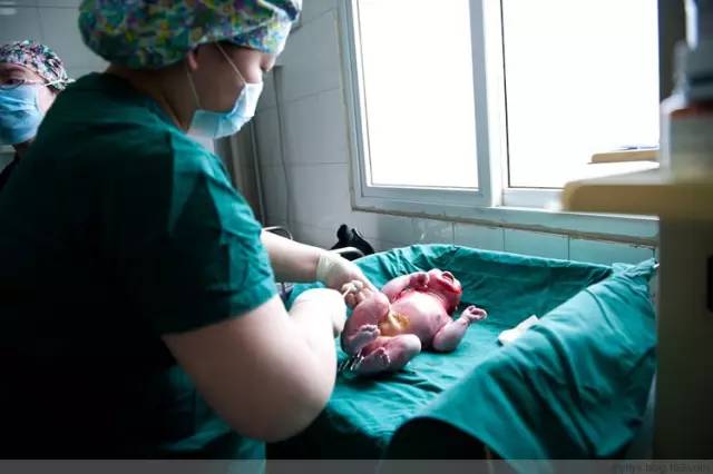 剖腹产恢复很好的照片,剖腹产完全恢复照片