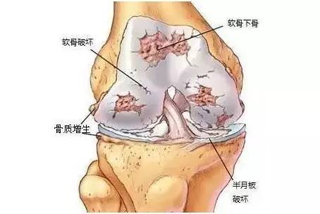 弹力绷带膝盖使用方法,膝盖部位型冷敷凝胶说明书