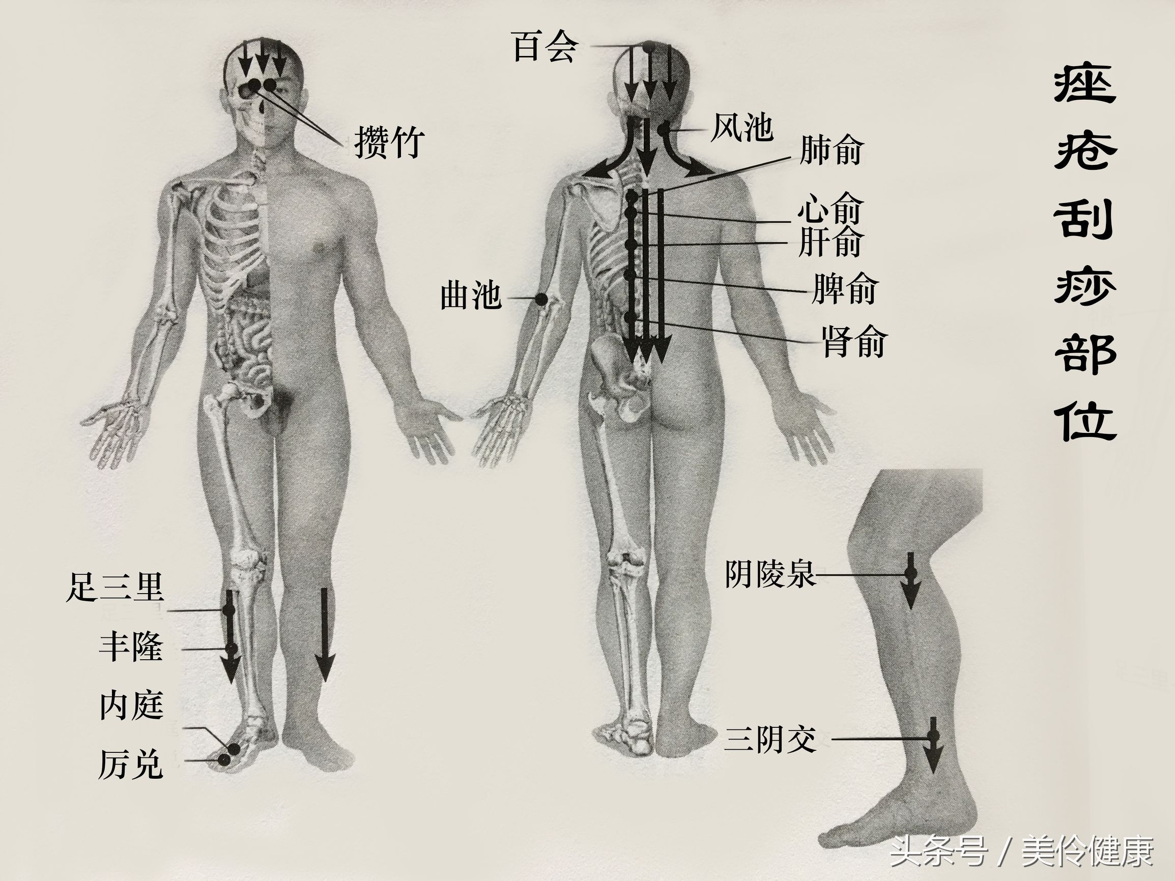 刮痧治疗白癜风偏方,荨麻疹刮痧疗法