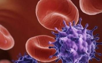 人们对艾滋病的刻板印象,对艾滋病的误解的宣传视频