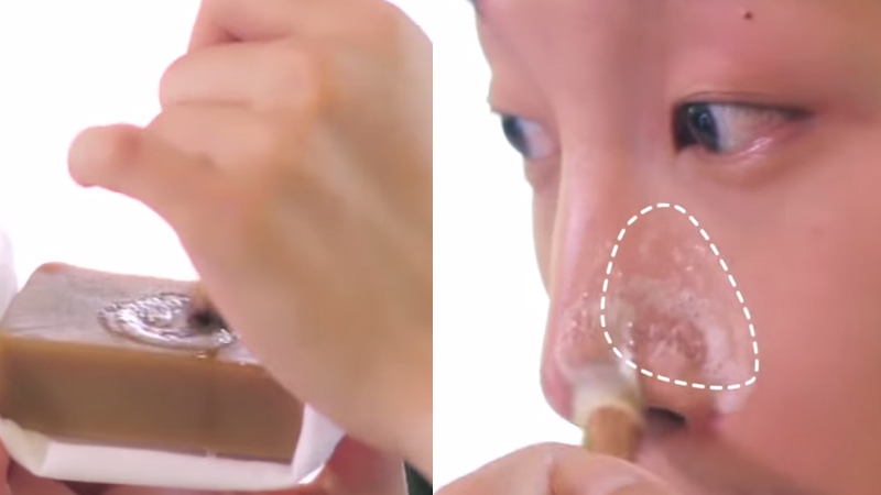 男生祛黑头小妙招,14岁男生鼻子有黑头咋办