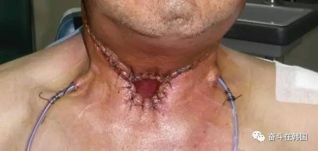 琚姝㈢殑鍏棣欑儫鍥剧墖,鐑熺洅寰堟伓蹇冪殑鏄粈涔堢儫