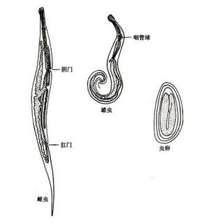 幼儿园蛲虫病检查,幼儿园小女孩蛲虫病