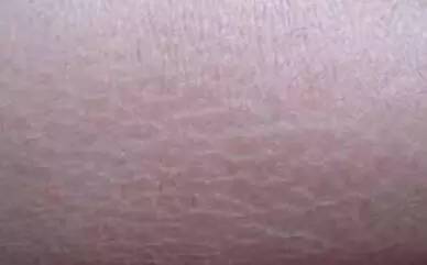 据说大部分的中国人到新加坡之后都有这种“病”!