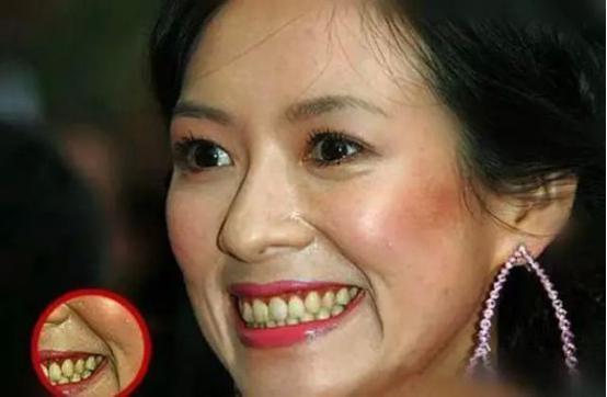 一白遮三丑皮肤白,一白遮三丑一口龅牙毁所有