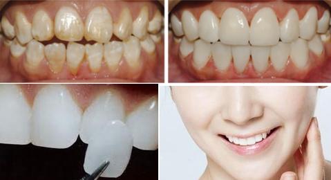 一白遮三丑皮肤白,一白遮三丑一口龅牙毁所有