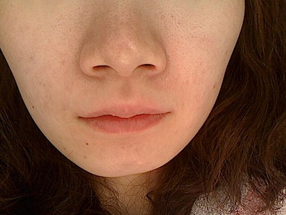 皮肤粗糙毛孔粗大改善方法内调,改善皮肤粗糙毛孔粗大小妙招