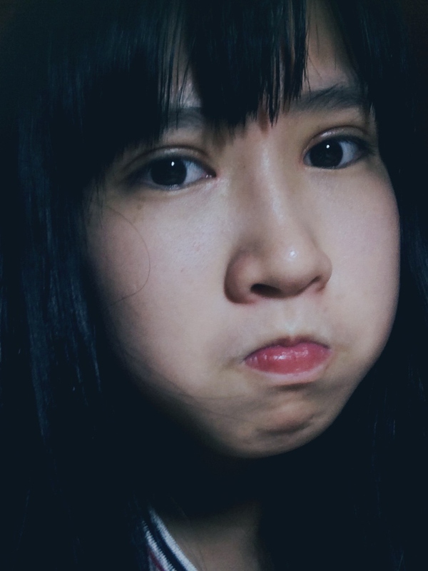 割完双眼皮后眼部吸脂,抽脂双眼皮做完眼睛有褶