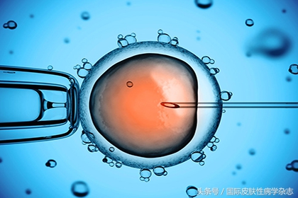 移植物抗宿主病的皮肤表现及治疗进展