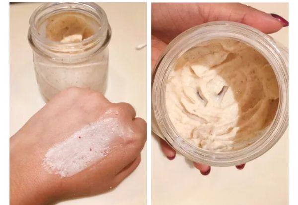 冬季皮肤粗糙有凸起,冬天皮肤真实状态