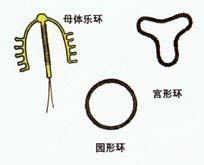 上环手术记录全过程,上环手术的流程