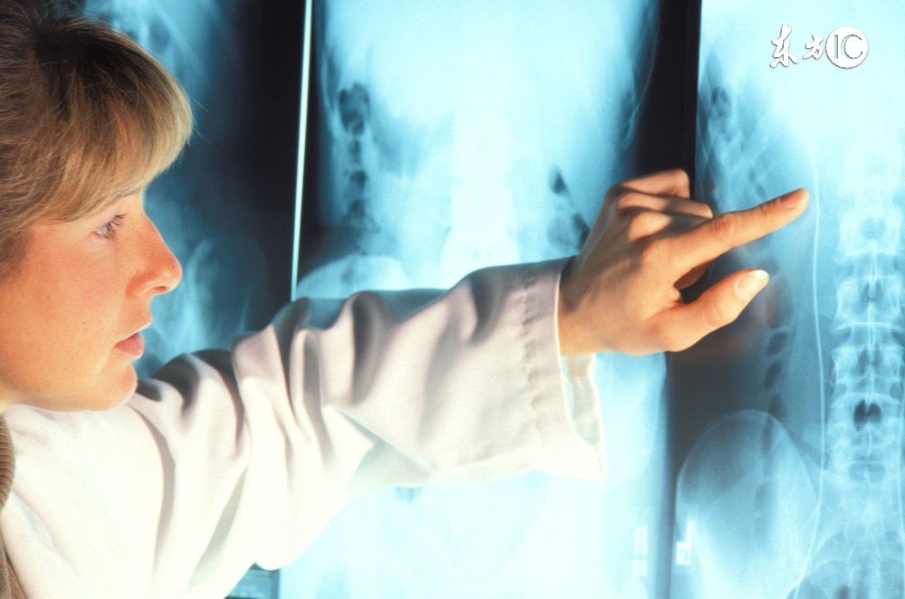 骨刺消痛液药方,一个骨刺的特效外敷药方