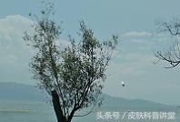 皮肤科疱疹,皮肤科一问一答