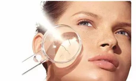 褐青色斑没救了吗,褐青色斑注意什么