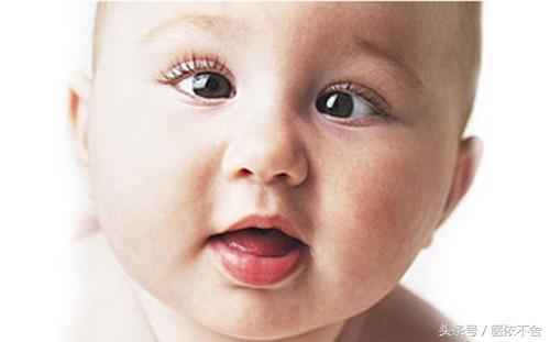 小宝宝眼睛斜视引斜颈怎么办,小宝宝眼睛对眼
