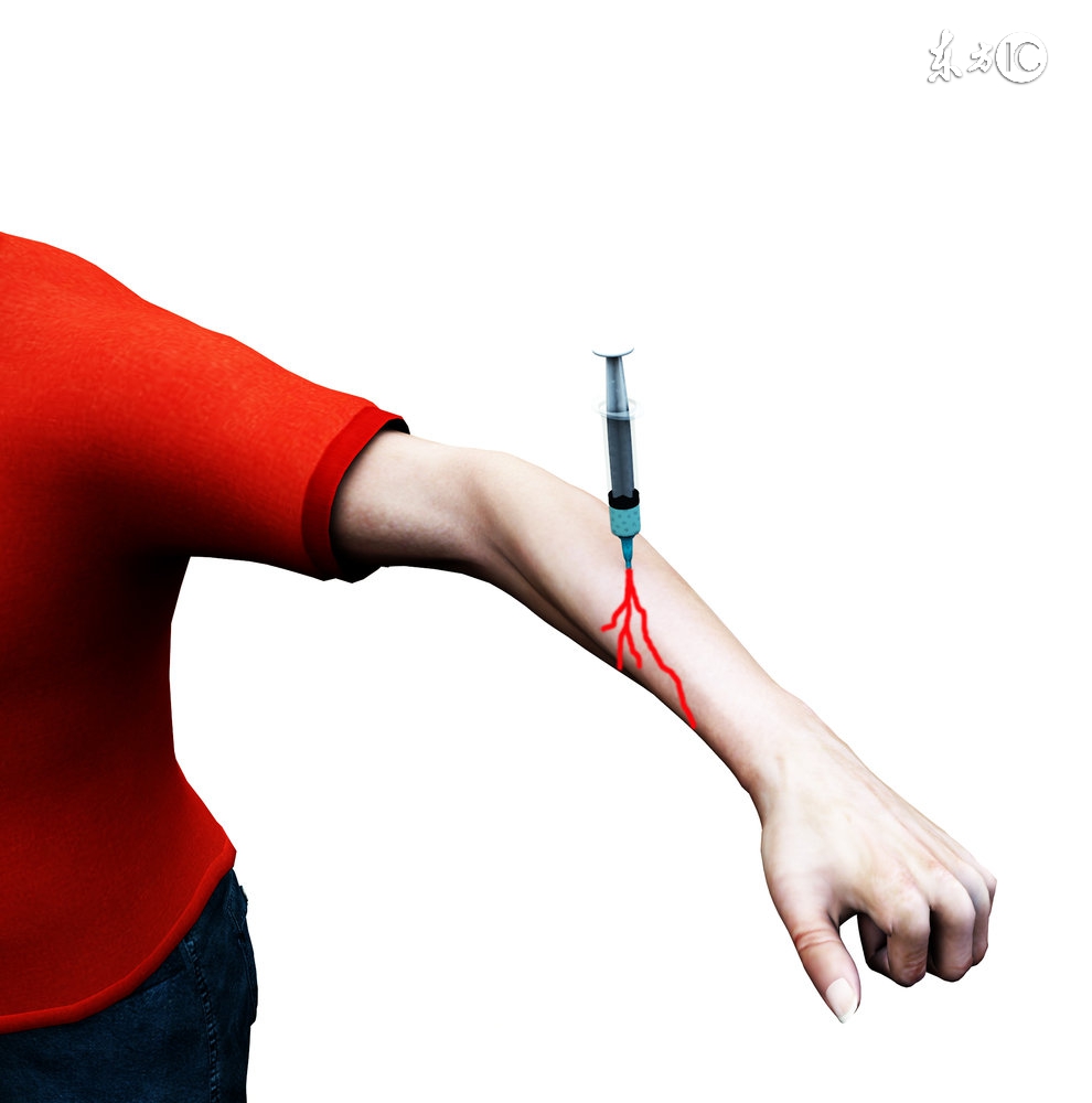 留置针针眼出血要紧吗,抽血后针眼出血