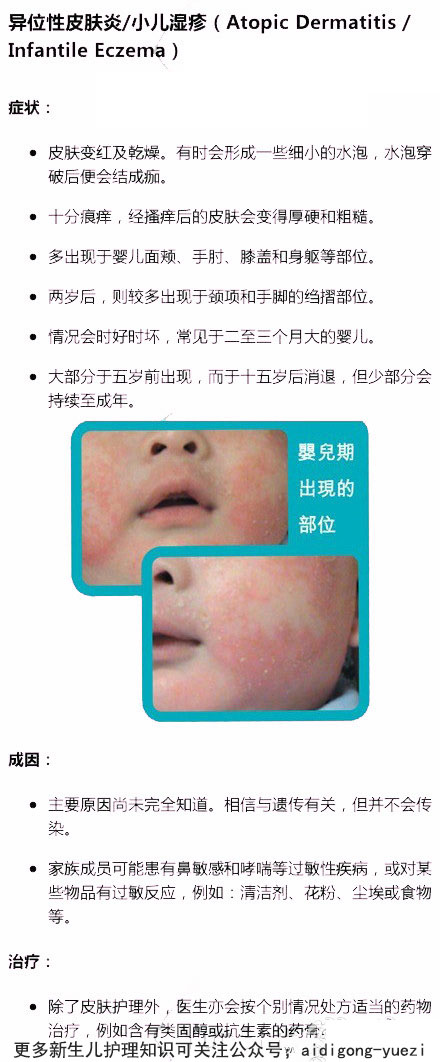 湿疹or热痱，傻傻分不清!八种宝宝常见皮肤问题及护理指南