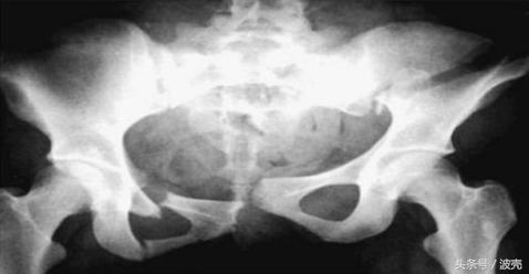 南方女婴,女孩一出生就被亲人挑断四肢