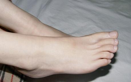 孕妇小腿浮肿怎么解决,孕妇小腿浮肿怎么回事