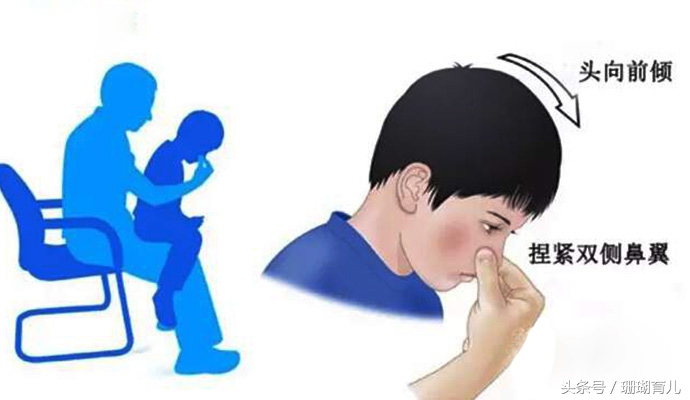育儿经验分享孩子容易流鼻血,小孩流鼻血怎么快速止血倪海厦
