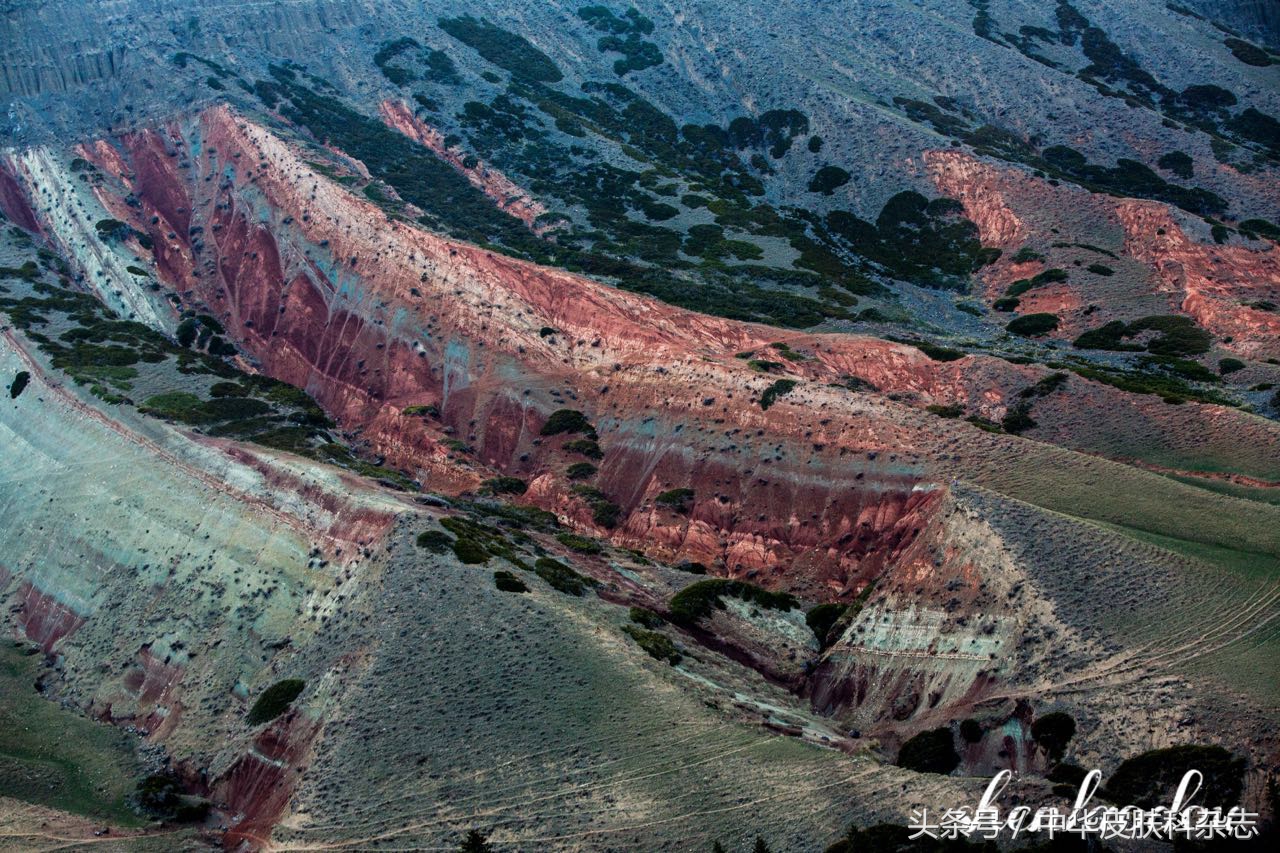 尖锐性湿疣怎么又复发了,尖锐性湿疣避免复发办法
