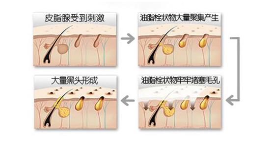 下巴长小丘疹连成片发红结痂,下巴长了密密麻麻的小丘疹怎么办