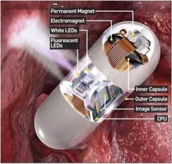 胃病患者要了解：各类胶囊机器人是如何高效无痛治胃病的